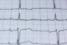 cosmic technology advancement revealed